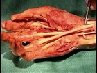 Human Anatomy Dissection 23 (part 2 of 2) Forearm and Hand