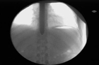 Sword-Swallower Dan Meyer X-ray Fluoroscope